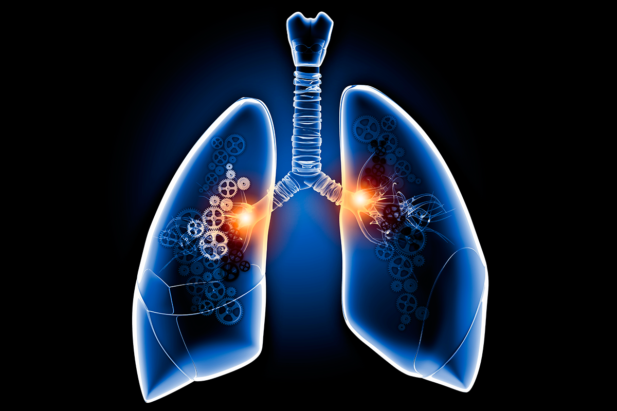 las-grasas-aumentan-la-inflamacion-de-los-linfocitos-t-en-los-pulmone