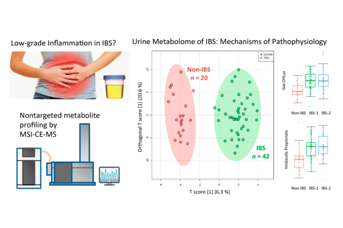 identifican-metabolitos-urinarios-asociados-al-sindrome-de-intestino