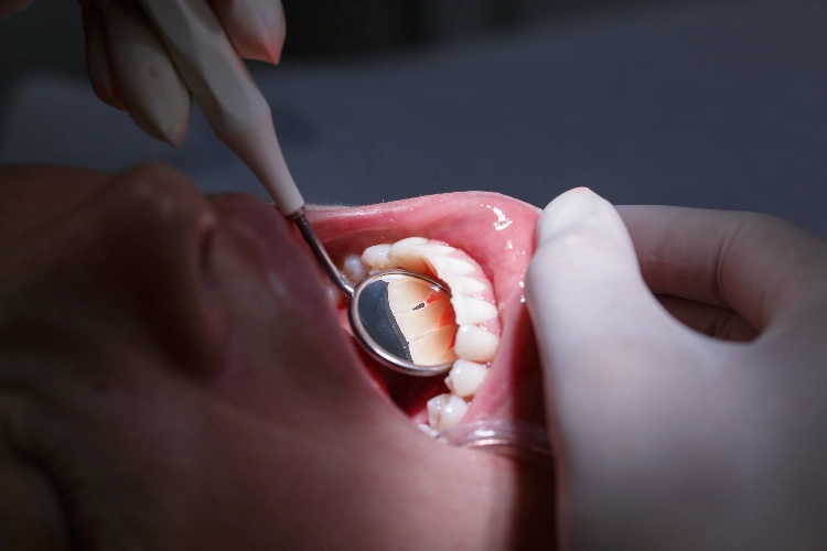 vinculan-la-enfermedad-periodontal-a-cada-vez-mas-riesgos-para-la-sal
