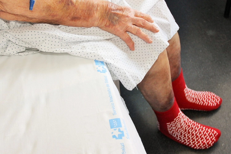 evitar-caidas-de-pacientes-hospitalizados-con-calcetines-antideslizan
