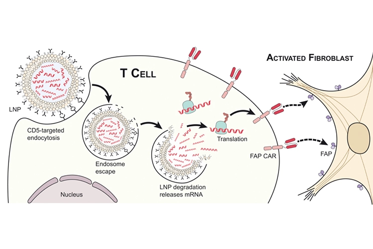 nanoparticulas-de-arn-transforman-los-linfocitos-t-en-terapias-cart
