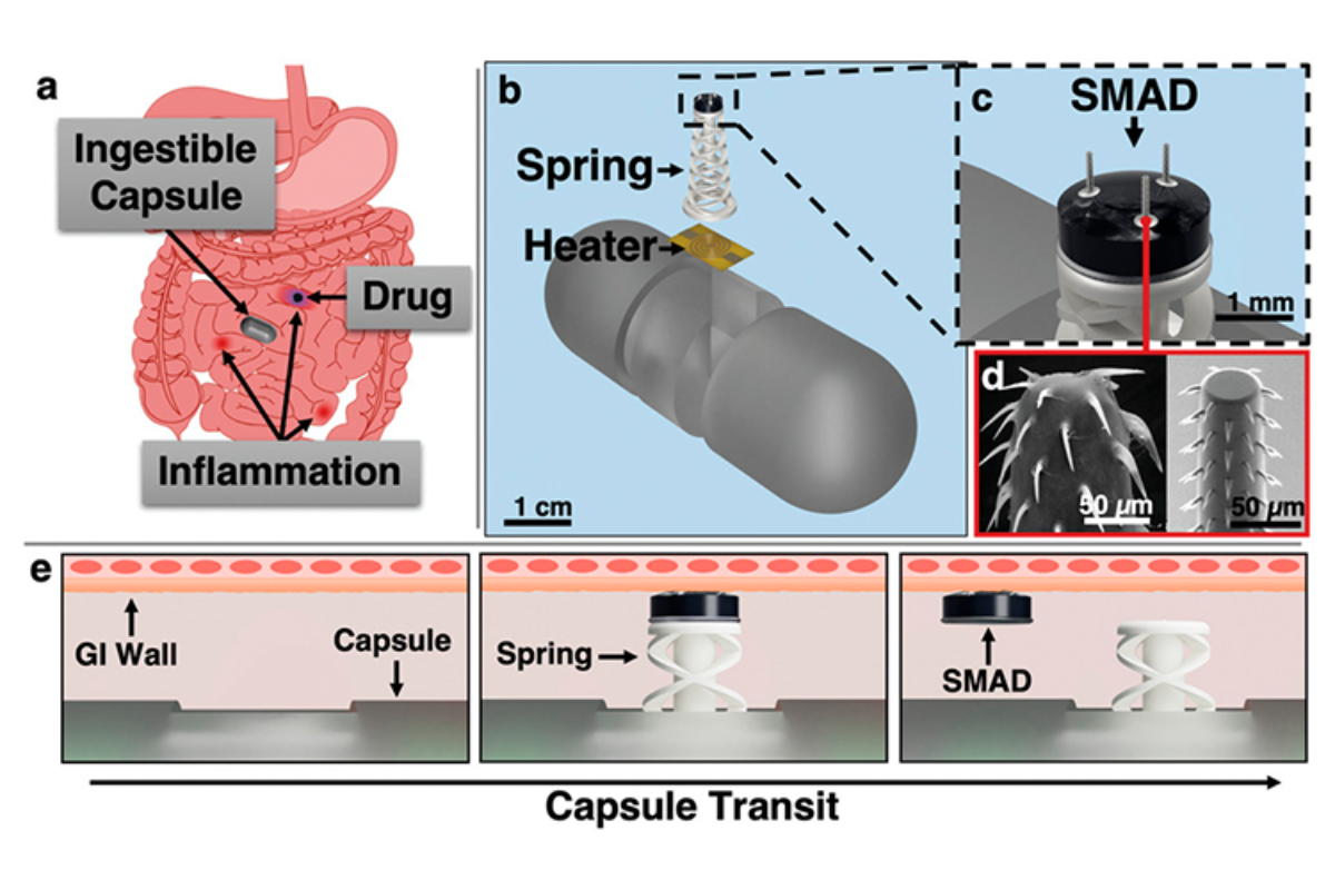 A thermomechanical device improves the delivery of drugs for their sustained release in the digestive tract