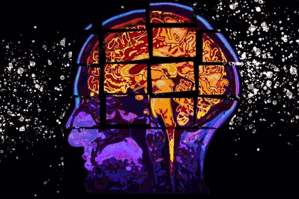 Vías celulares podrían convertirse en nuevas dianas farmacológicas contra el Alzheimer